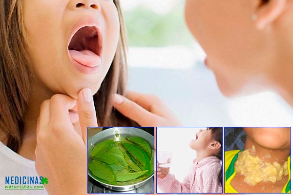 Adenoiditis infantil, respiración bucal y ronquidos en niños