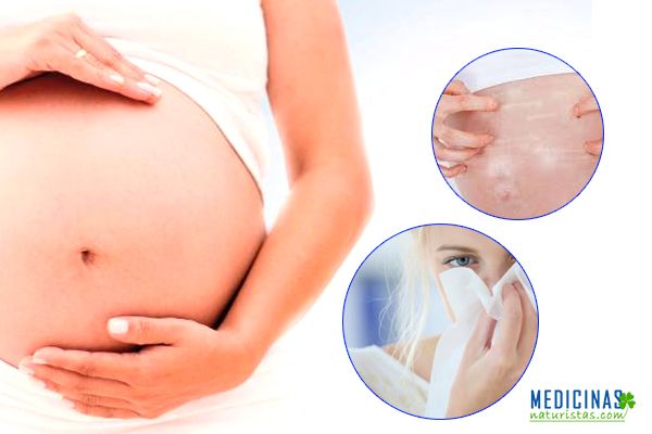 Alergias durante el embarazo, prevención y remedios