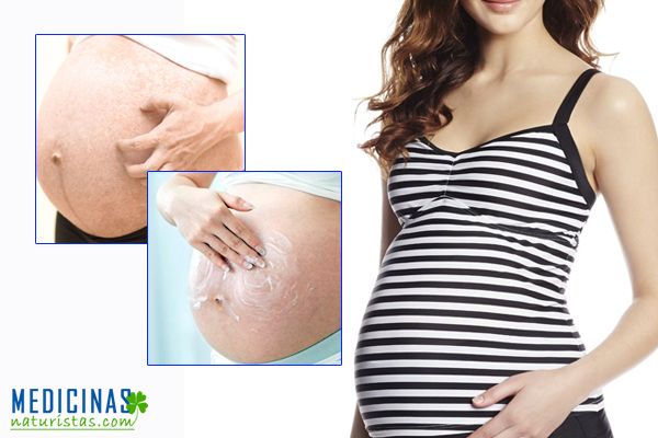 Comezón en la piel durante el embarazo, soluciones naturales