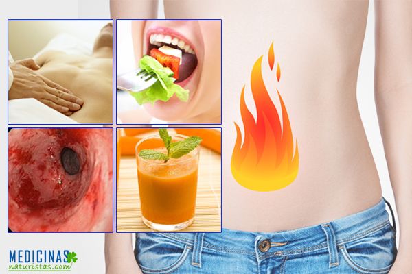 Gastritis causas, síntomas, diagnóstico y tipos